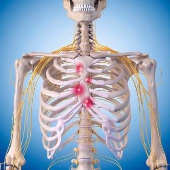 Боль в суставах грудной клетки - причины и лечение